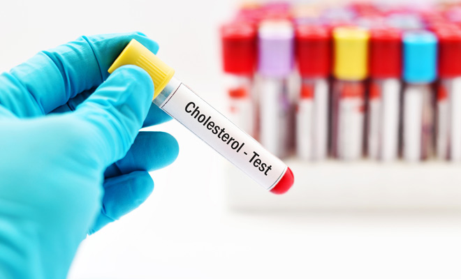 Cholesterol test in Kent | Intrigue Health.