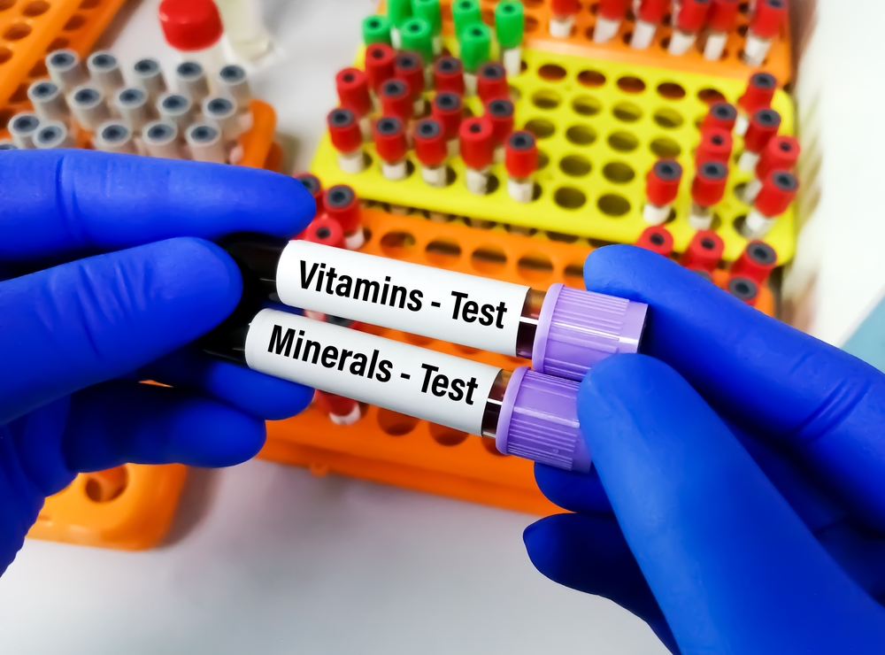 4 Reasons You Need a Private Vitamin Blood Profile Test