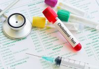 The Importance of Regular Cholesterol Testing for Heart Health