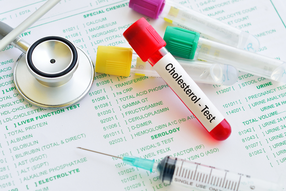 The Importance of Regular Cholesterol Testing for Heart Health