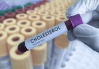 Cholesterol blood test in bexley