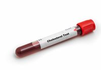 Protect Your Heart in the Summer: Understanding the Value of Cholesterol Testing