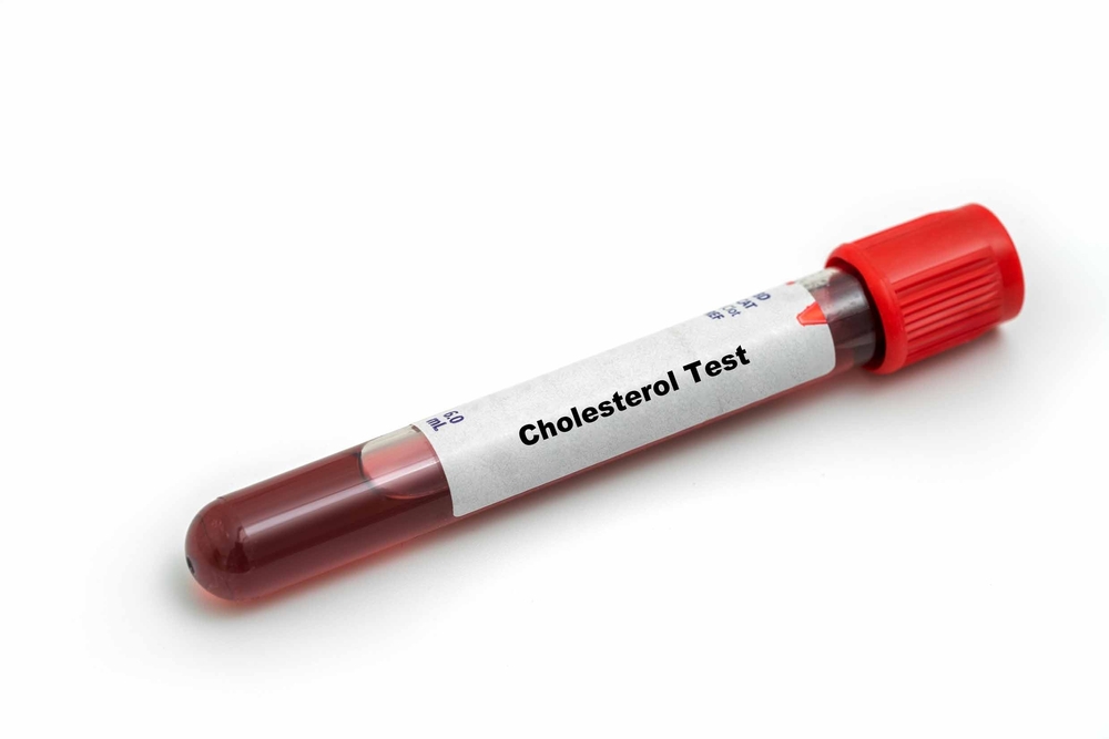 Protect Your Heart in the Summer: Understanding the Value of Cholesterol Testing
