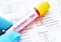 Cholesterol Test