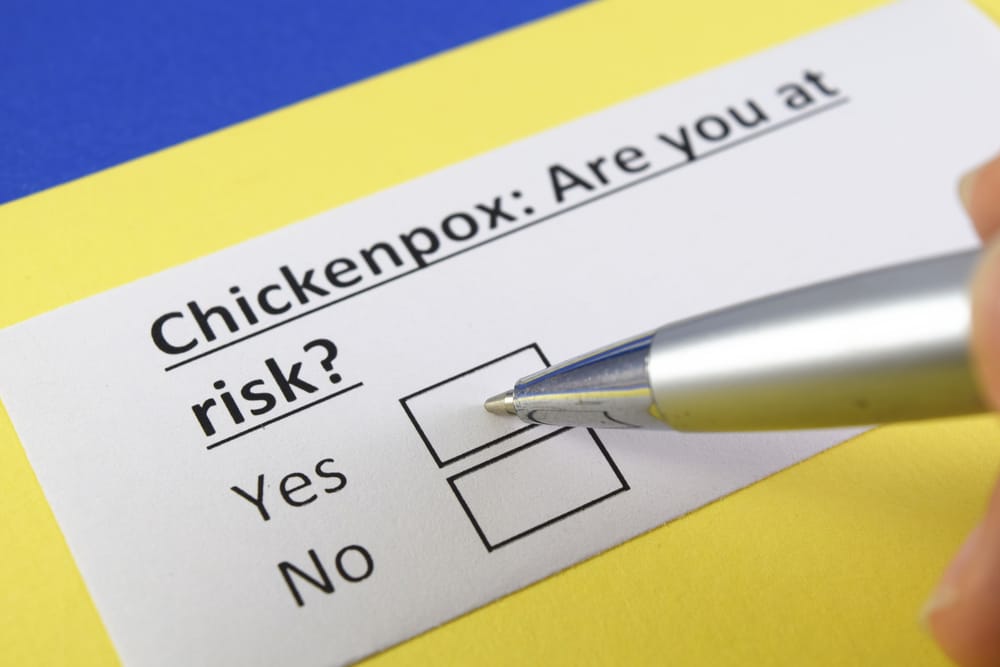 How to Prevent and Control the Spread of Chickenpox?