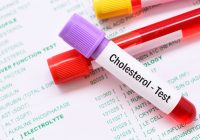 Get cholesterol test in dartford