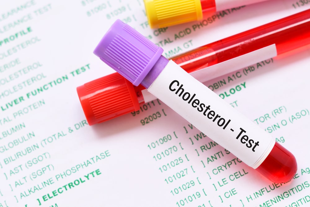 Who Should Get Cholesterol Tested?