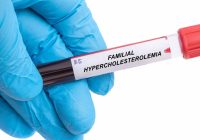 Familial Hypercholesterolemia test in kent at intrigue health