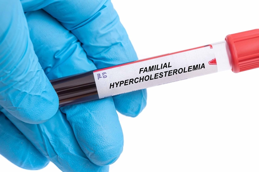 Familial Hypercholesterolemia: Symptoms, Causes, and Risks