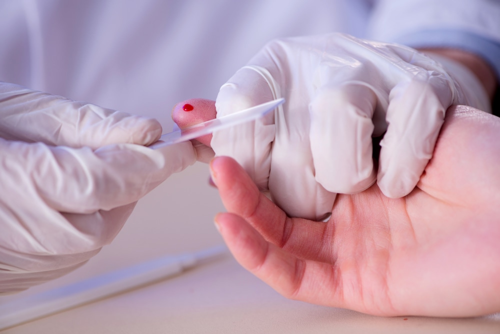 Finger prick blood Testing: Steps, Best Practices, FAQs, and Tips